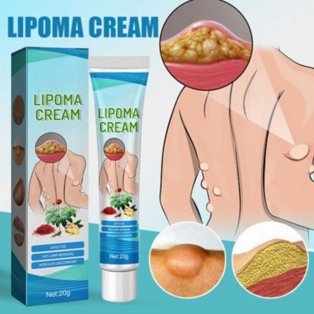 South Moon™ Lipoma Treatment Ointment Original